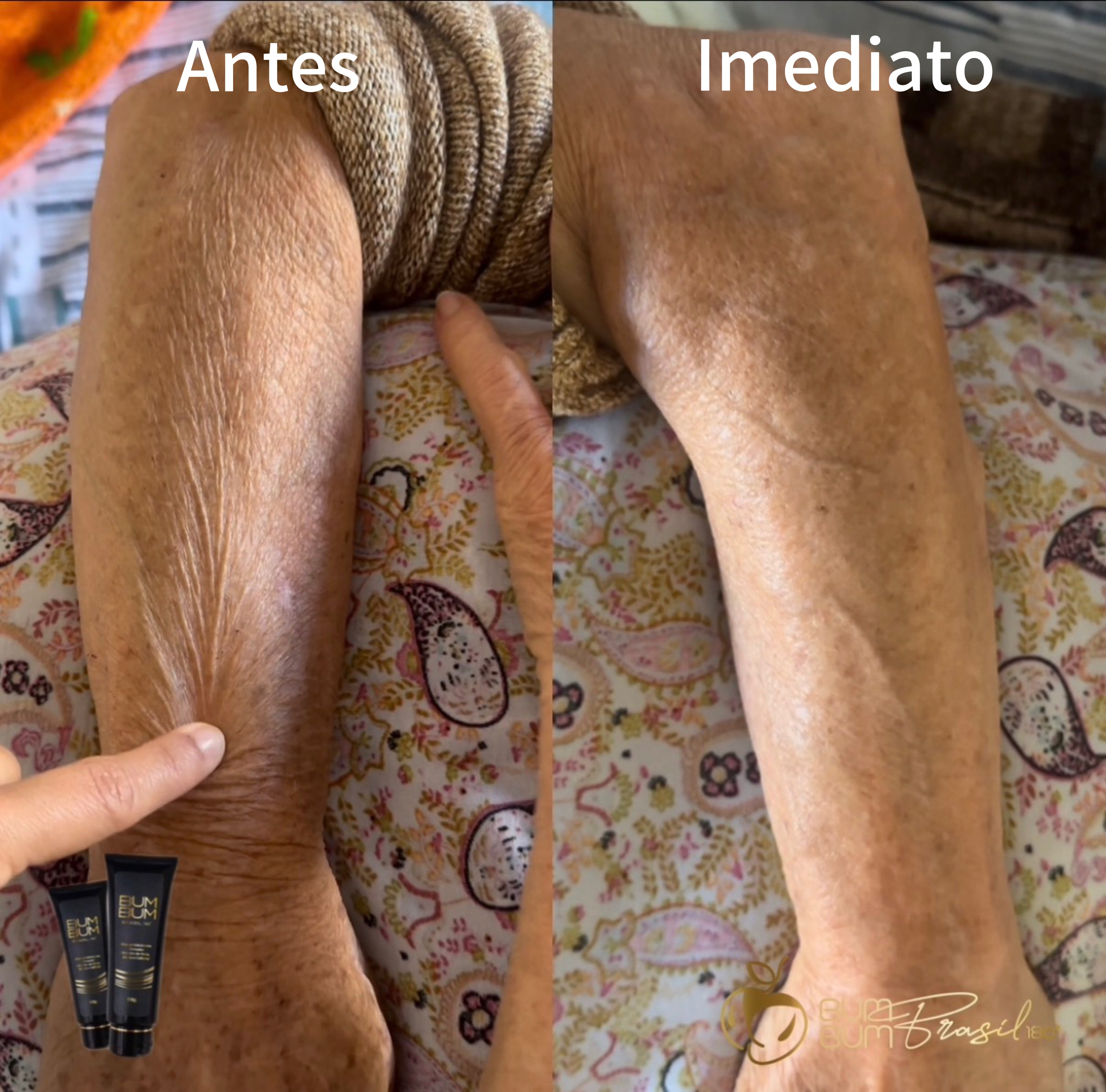 BumBum Brasil 180°  (Disponível Europa & USA)