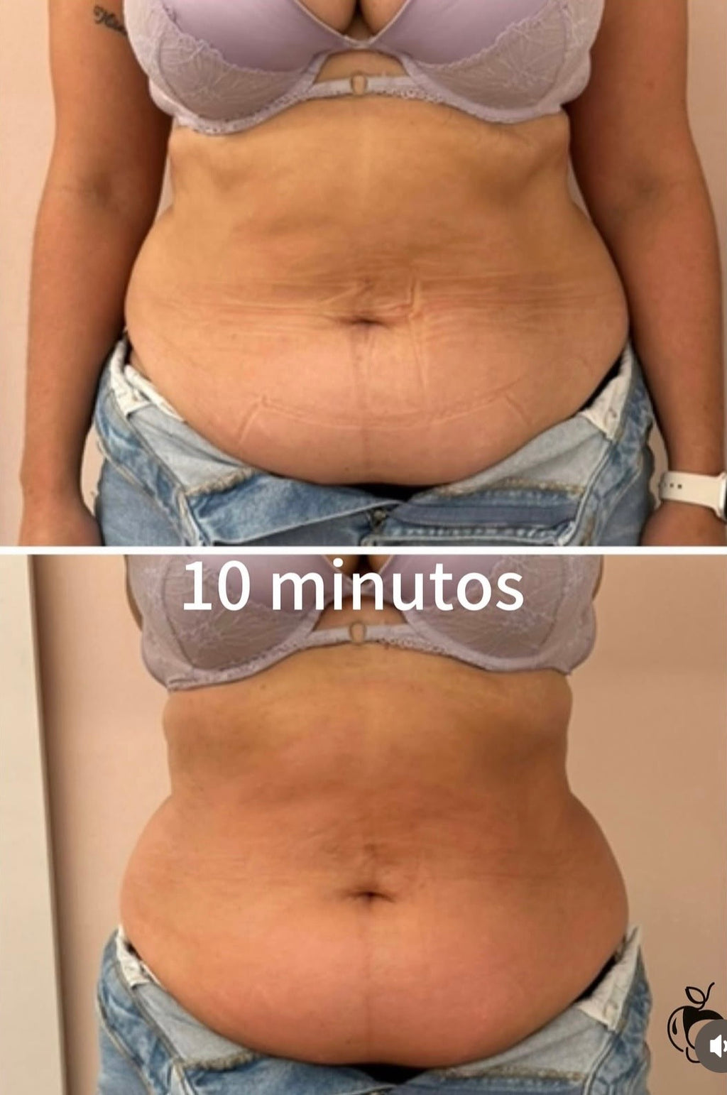 BumBum Brasil 180°  (Disponível Europa & USA)